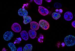 Cellules cancéreuses colorectales humaines traitées avec un inhibiteur